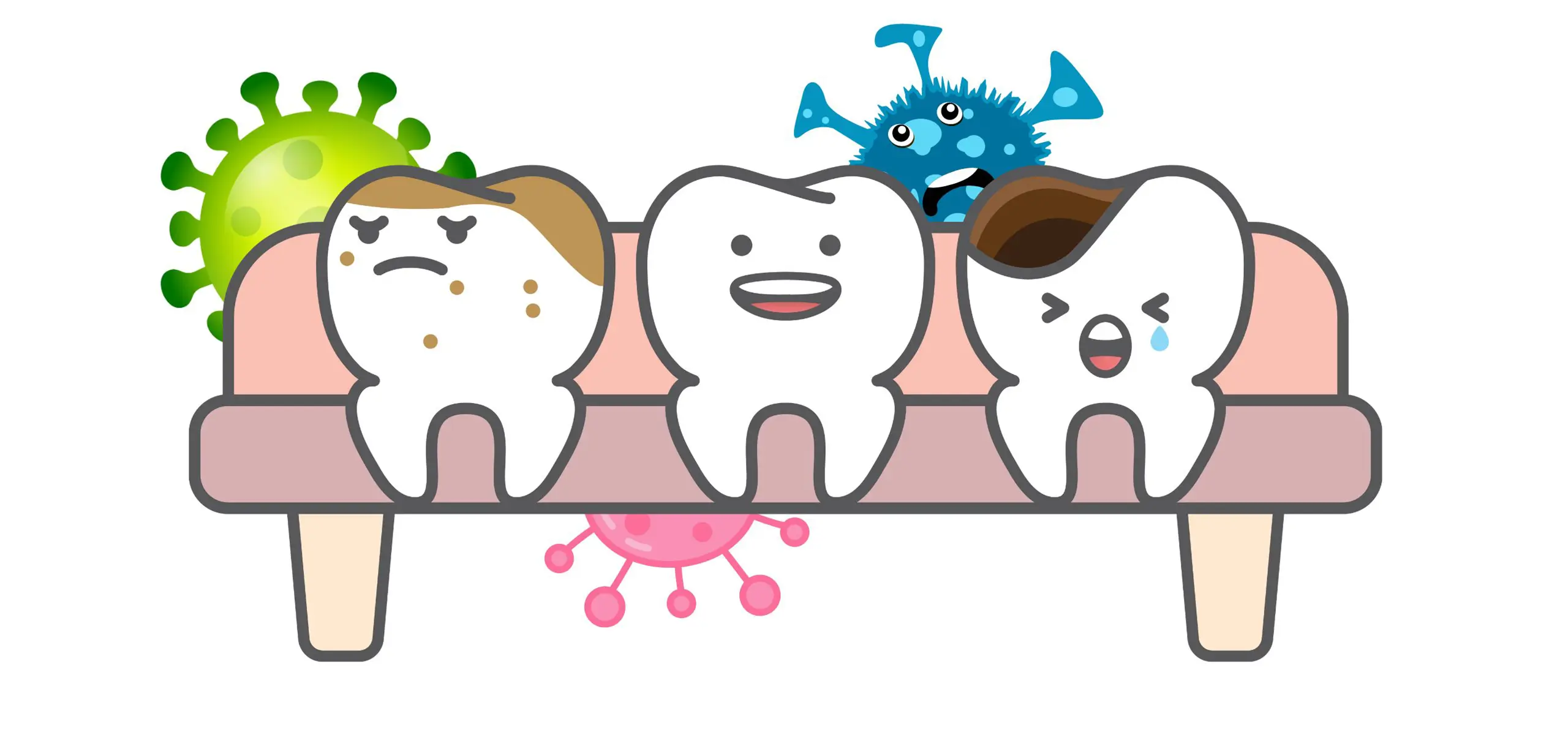 Ce sunt cariile dentare